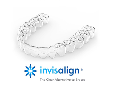 invisalign-tray.jpg